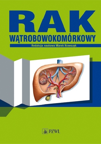 Rak wątrobowokomórkowy