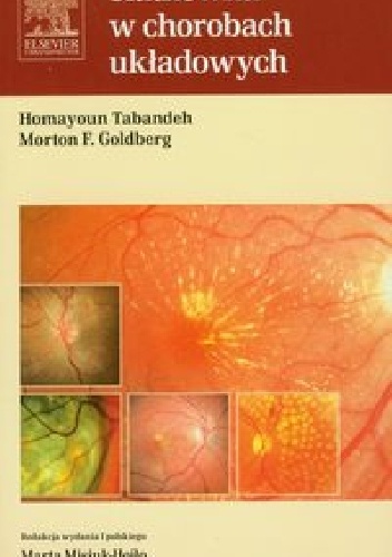 Siatkówka w chorobach układowych - Homayoun Tabandeh, Morton F. Goldberg