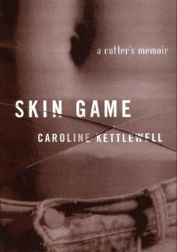 Skin Game: A Memoir - Caroline Kettlewell