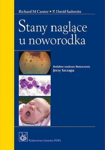 Stany naglące u noworodka - Richard M. Cantor, David Sadowitz