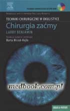 Techniki chirurgiczne w okulistyce: Chirurgia zaćmy - Larry Benjamin