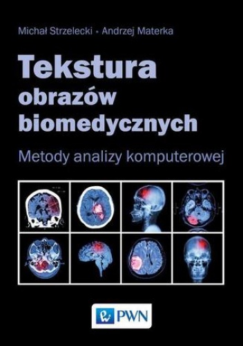 Tekstura obrazów biomedycznych - Michał Strzelecki, Materka Andrzej