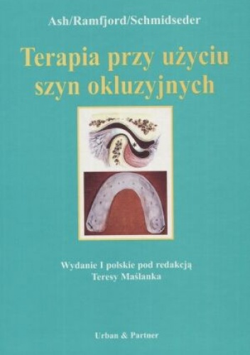 Terapia przy użyciu szyn okluzyjnych
