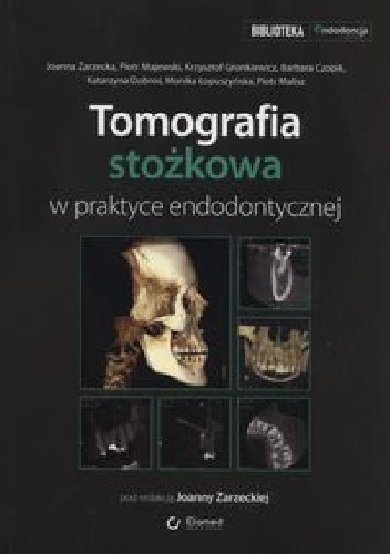 Tomografia stożkowa w praktyce endodontycznej - Joanna Zarzecka