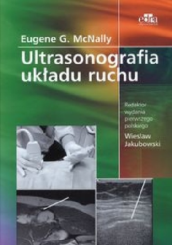 Ultrasonografia układu ruchu - Eugene G. McNally