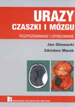 Urazy czaszki i mózgu. Rozpoznawanie i opiniowanie - Zdzisław Marek, Jan Głowacki