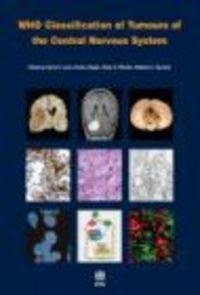 WHO Classification of Tumours of the Central Nervous System - D. Louis