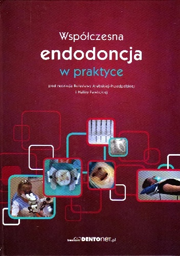 Współczesna endodoncja w praktyce