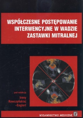 Współczesne postepowanie interwencyjne w wadzie zastawki mitralnej - Irena Rawczyńska-Englert