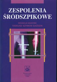 zespolenia śródszpikowe - Tadeusz Szymon Gaździk