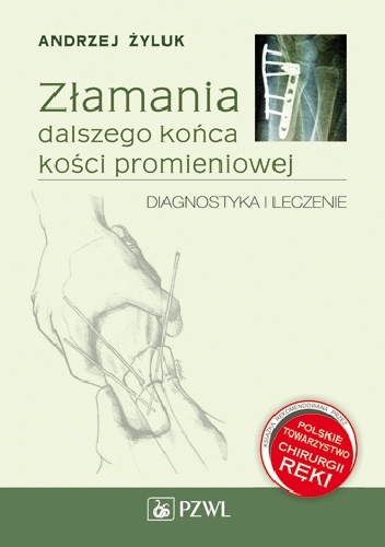 Złamania dalszego końca kości promieniowej. Diagnostyka i leczenie - Andrzej Żyluk