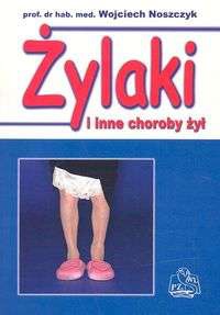 Żylaki i inne choroby żył - Wojciech Noszczyk