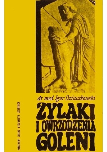 Żylaki i owrzodzenia goleni - Igor Dziaczkowski