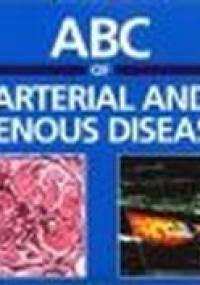 ABC of Arterial & Venous Disease CD ROM Slide - R. Donnelly