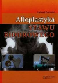 Alloplastyka stawu biodrowego - Andrzej Pozowski