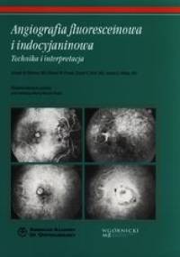 Angiografia fluoresceinowa i indocyjaninowa