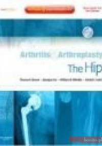 Arthritis and Arthroplasty The Hip with DVD