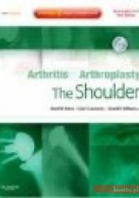 Arthritis and Arthroplasty The Shoulder - D. Dines