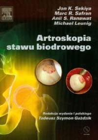 Artroskopia stawu biodrowego