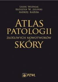 Atlas patologii złośliwych nowotworów skóry
