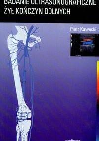 Badanie ultrasonograficzne żył kończyn dolnych - Piotr Kawecki