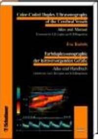 Color-Coded Duplex Sonography of Cerebral Vessels - Bartels