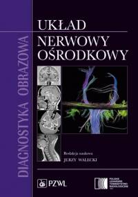 Diagnostyka obrazowa. Układ nerwowy ośrodkowy