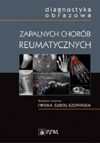Diagnostyka obrazowa zapalnych chorób reumatycznych