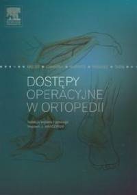 Dostępy operacyjne w ortopedii