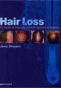 Hair Loss - Jerry Shapiro