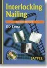 Interlocking Nailing 2E - D. D. Tanna