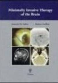 Minimally Invasive Therapy of Brain - Robert Lufkin