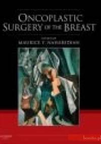 Oncoplastic Surgery of the Breast with DVD - M. Nahabedian
