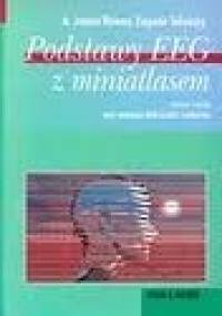 Podstawy EEG z miniatlasem - James Rowan, Eugene Tolunsky