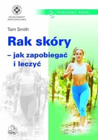 Rak skóry - jak zapobiegać i leczyć