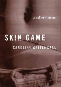 Skin Game: A Memoir - Caroline Kettlewell