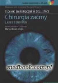 Techniki chirurgiczne w okulistyce: Chirurgia zaćmy - Larry Benjamin