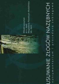 Usuwanie złogów nazębnych - W. Jurczyński