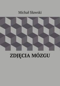 Zdjęcia mózgu - Sławski Michał