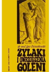Żylaki i owrzodzenia goleni - Igor Dziaczkowski